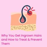 Why You Get Ingrown Hairs and How to Treat & Prevent Them